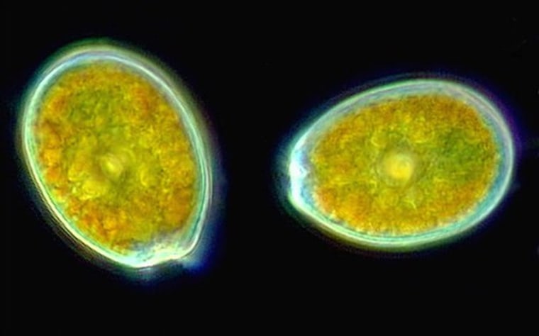 Prorocentrum, an unusual dinoflagellate with two large valves, is often marked with pores which can be used in the identification of species. 